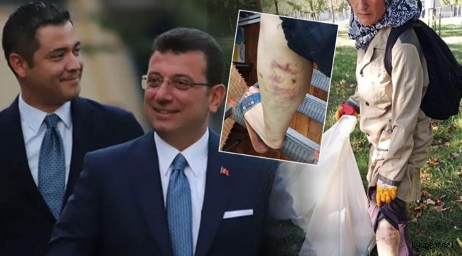 Murat Ongun, köpeğinin ısırdığı kadını işten çıkardı